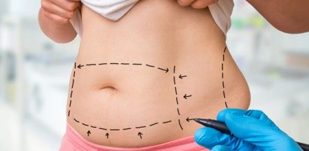Rekonwalescencja po liposukcji - masaż i ubrania uciskowe na opuchliznę oraz obrzęki